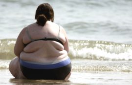 obesidad mórbida