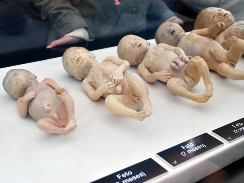 "BODIES 2.0, cuerpos humanos reales" en Valparaíso.