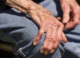 La artrosis es la enfermedad articular más prevalente a partir de los 50 años.