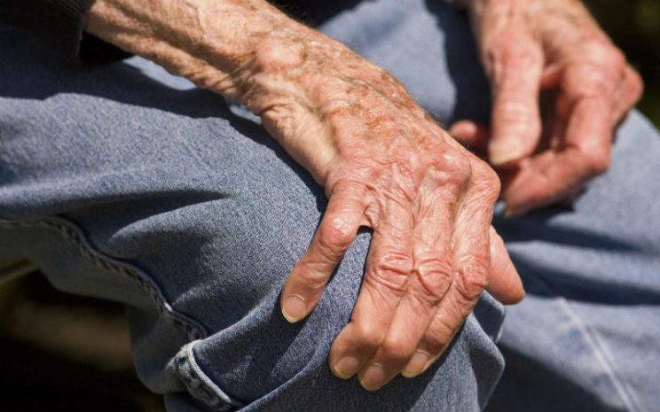 La artrosis es la enfermedad articular más prevalente a partir de los 50 años.
